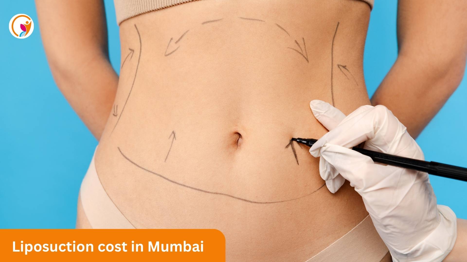 Liposuctioon Cost in mumbai