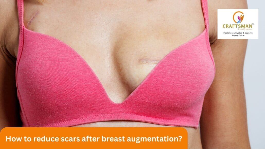 How to Reduce Scars After Breast Augmentation