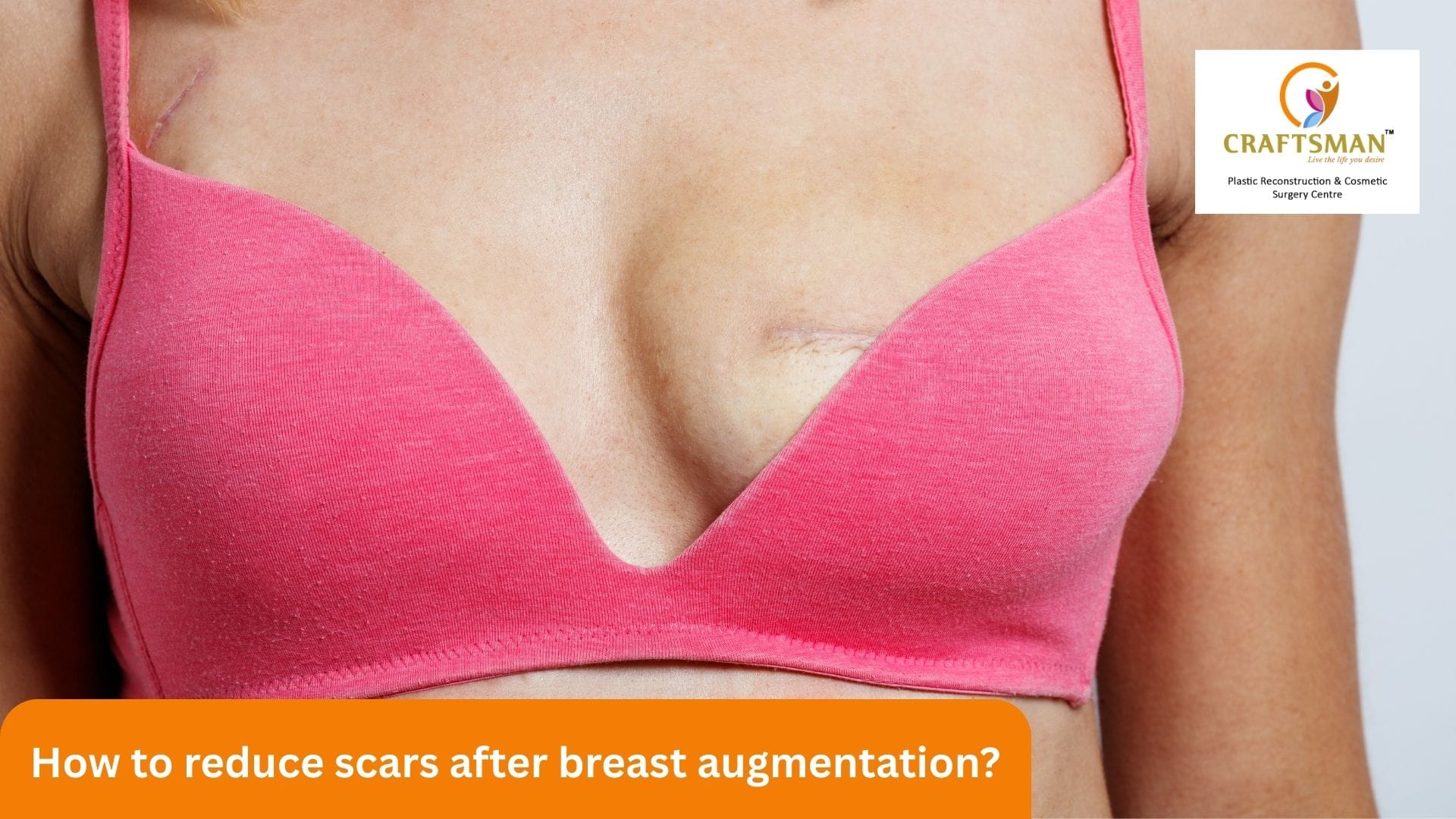 How to Reduce Scars After Breast Augmentation