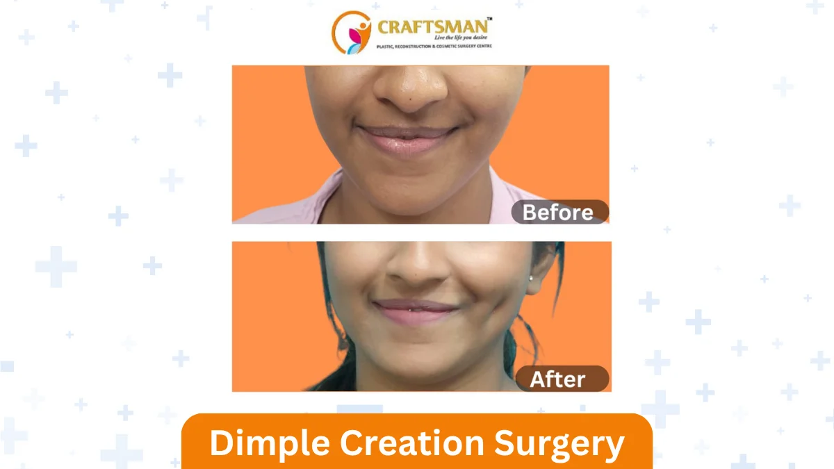 Dimple Creation Surgery in mumbai
