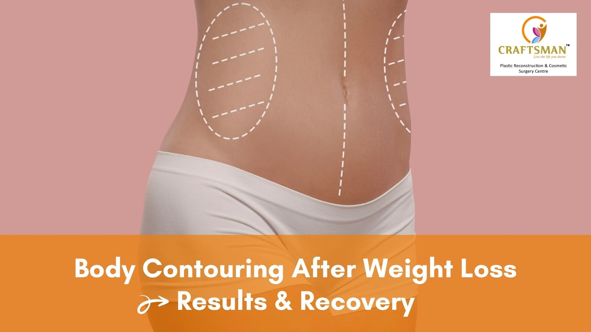 Body Contouring After Weight Loss