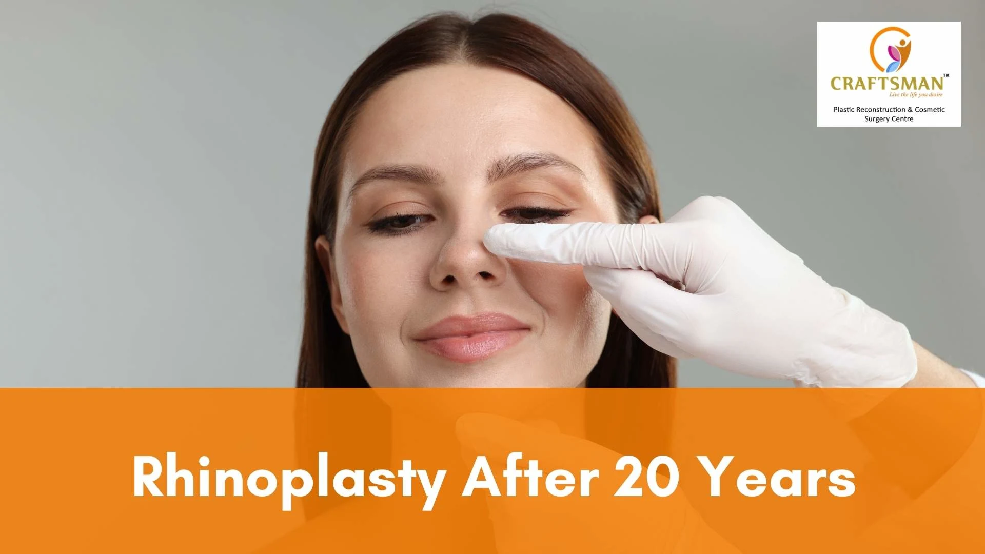 Rhinoplasty After 20 Years