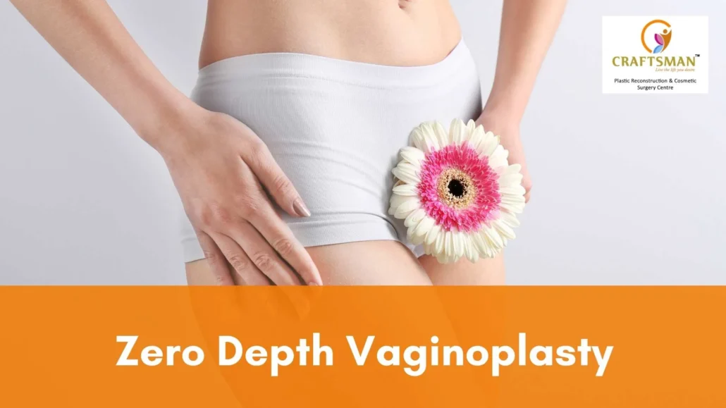 Zero Depth Vaginoplasty